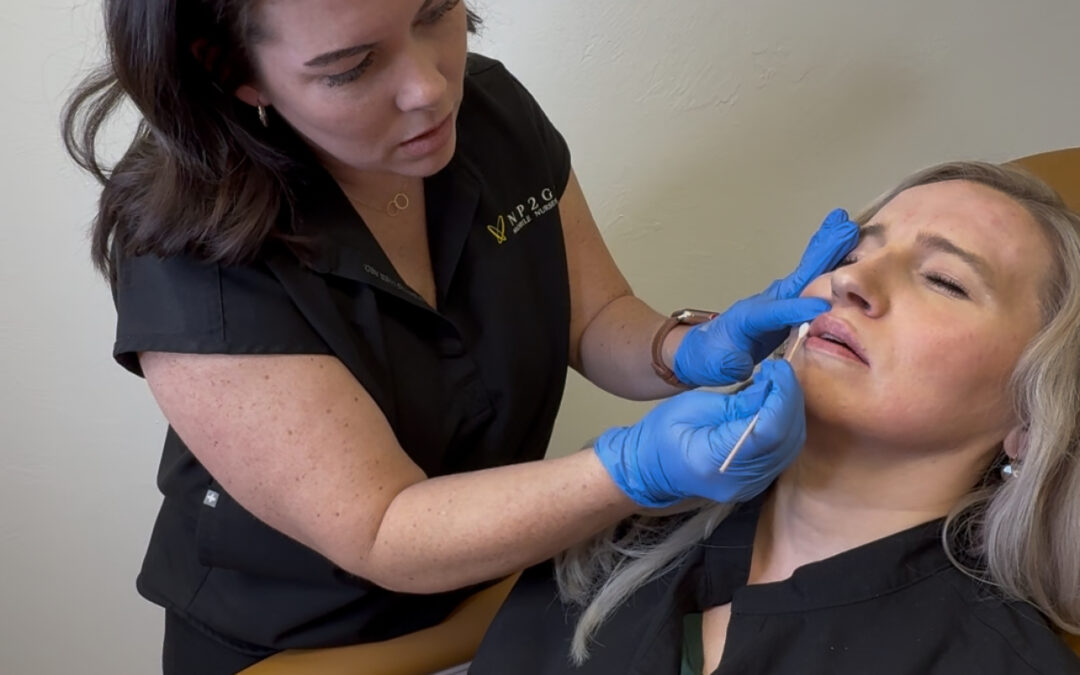 Blog - NP2GO Lip Filler Near Me, In Edmond, Oklahoma