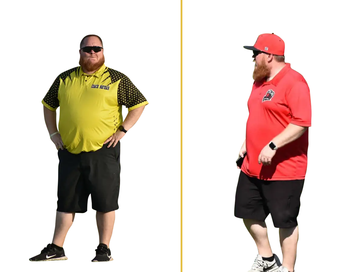 A man, Nathan, before and after his weight loss journey